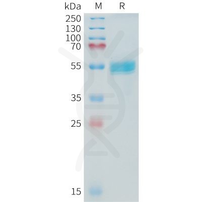 sp-PME C100019 TNFSF15 Fig.1 SDS PAGE 1