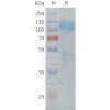 sp-PME C100029 CDH17 Fig.1 SDS PAGE 1