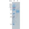 sp-PME C100031 B7 H6 Fig.1 SDS PAGE 1