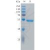 sp-PME C100032 CA9 Fig.1 SDS PAGE 1