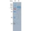 sp-PME C100036 EGFR Fig.1 SDS PAGE 1