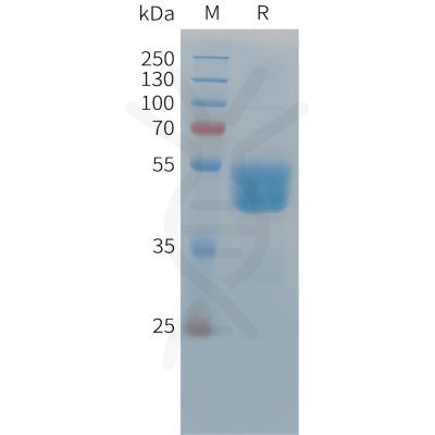 sp-PME C100038 TIGIT Fig.1 SDS PAGE 1