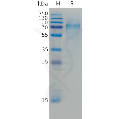 sp-PME C100052 CD30 Fig.1 SDS PAGE 1