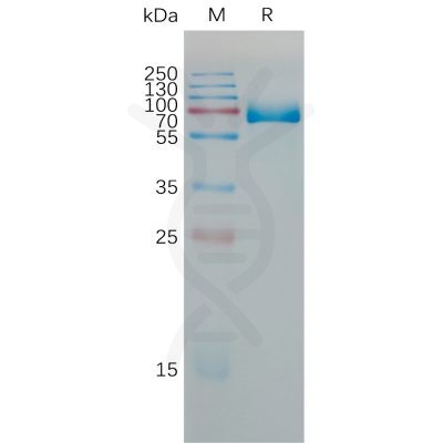 sp-PME M100077 PD L1 Fig.1 SDS PAGE 1