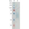 sp-PME M100078 B7 H4 Fig.1 SDS PAGE 1