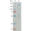 sp-PME M100081 CD45 Fig.1 SDS PAGE 1