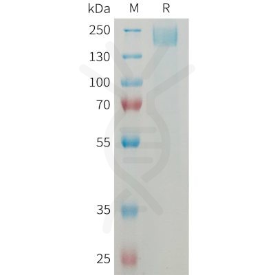 sp-PME M100083 SEZ6 Fig.1 SDS PAGE 1