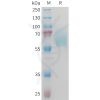 sp-PME M100094 AXL Fig.1 SDS PAGE 1