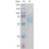 sp-PME M100094 AXL Fig.1 SDS PAGE 1