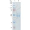 sp-PME M100097 ROR2 Fig.1 SDS PAGE 1