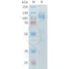 sp-PME M100098 CDH17 Fig.1 SDS PAGE 1