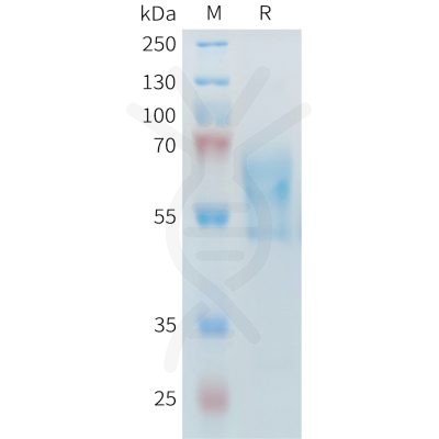 sp-PME M100099 PD 1 Fig.1 SDS PAGE 1