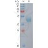 sp-PME M100106 CCR6 Fig.1 SDS PAGE 1