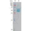 sp-PME M100111 PROM1 Fig.1 SDS PAGE 1