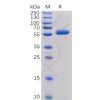 sp-PME100017 CTLA 4 Fig.1 SDS PAGE 1