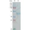 sp-PME100199 CDH17 Fig.1 SDS PAGE 1 1