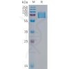 sp-PME100317 KIR2DL1 Fig.1 SDS PAGE 1