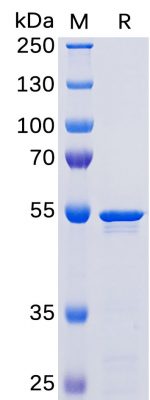 sp-PME100459 SARS CoV 2 2019 nCoV Nucleocapsid SP