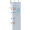 sp-PME100481 CD30 Fig.1 SDS PAGE 1