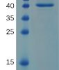 sp-PME100679 RNASE4 hFc PAGE 72