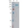 sp-PME100967 ITGB5 Fig.1 SDS PAGE 1
