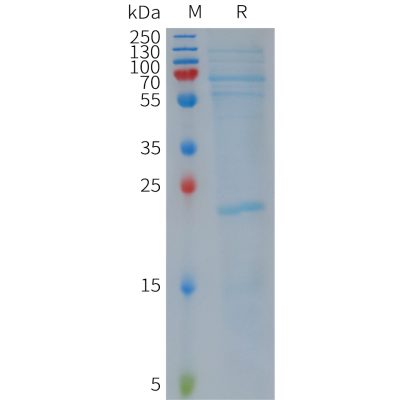 sp-PME101158 NLRP3 Fig.1 SDS PAGE 1