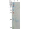 sp-PME101168 CXCL8 Fig.1 SDS PAGE 1