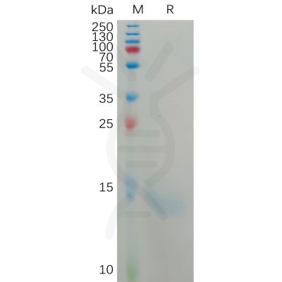 sp-PME101168 CXCL8 Fig.1 SDS PAGE 1