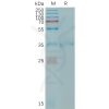 sp-PME101206 CLDN6 Fig.1 SDS PAGE 1
