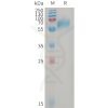 sp-PME101228 GPR56 Fig.1 SDS PAGE 1