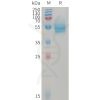 sp-PME101229 CD14 Fig.1 SDS PAGE 1