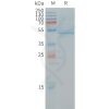 sp-PME101244 RHOC Fig.1 SDS PAGE 1