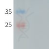 PME101246 human CXADR hFc recombinant protein
