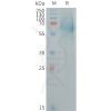 sp-PME101260 IGHE Fig.1 SDS PAGE 1