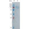 sp-PME101278 FCGR3B Fig.1 SDS PAGE 1