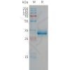 sp-PME101305 CGRP Fig.1 SDS PAGE 1