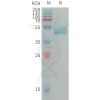 sp-PME101307 IL4 Fig.1 SDS PAGE 1