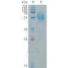 sp-PME101322 CD79A Fig.1 SDS PAGE 1