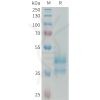 sp-PME101332 CCL24 Fig.1 SDS PAGE 1 1