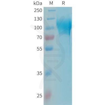 sp-PME101341 MAG Fig.1 SDS PAGE 1 1