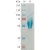 sp-PME101361 MADCAM1 Fig.1 SDS PAGE 1 1