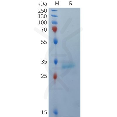 sp-PME101369 BCMA Fig.1 SDS PAGE 1