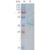 sp-PME101377 RAMP1 Fig.1 SDS PAGE 1