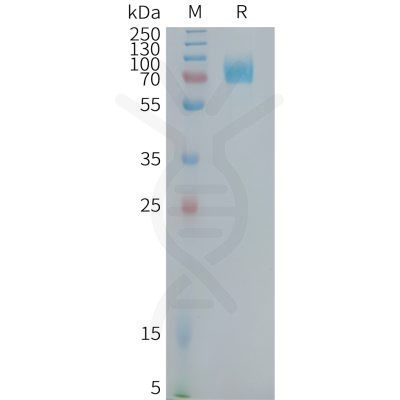 sp-PME101379 CD22 Fig.1 SDS PAGE 1