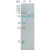 sp-PME101398 PLA2R1 Fig.1 SDS PAGE 1
