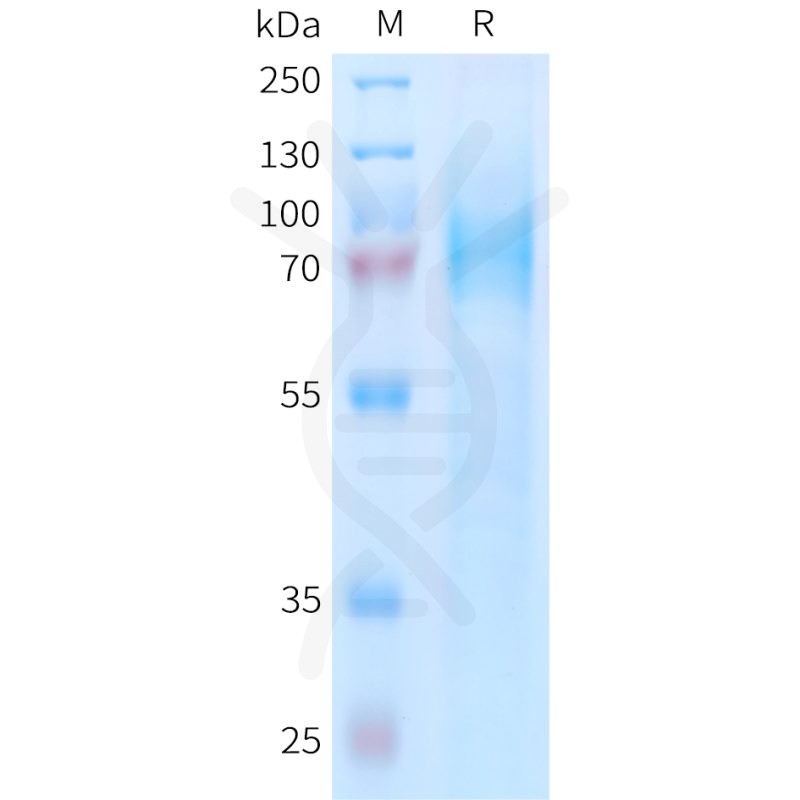 Human ADGRE5 Protein, His Tag - 专注肿瘤免疫
