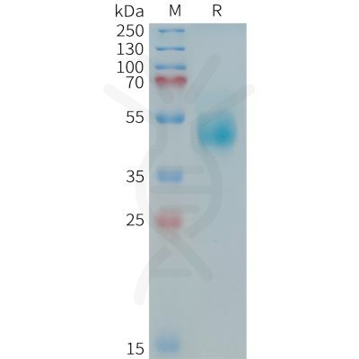 sp-PME101411 HER3 Fig.1 SDS PAGE 1