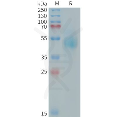 sp-PME101412 HER3 Fig.1 SDS PAGE 1