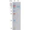 sp-PME101423 BAMBI Fig.1 SDS PAGE 1