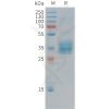 sp-pme c100039 mesothelin sp1